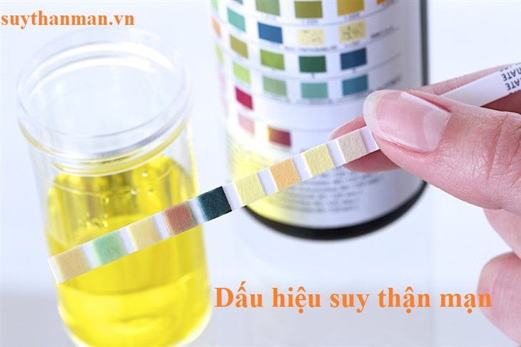 Suy thận mạn có mấy giai đoạn? Khi nào phải chạy thận?