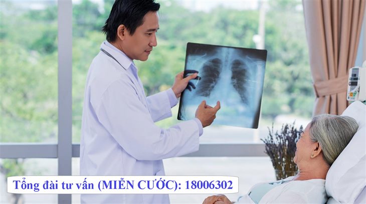 Ung thư phổi di căn hạch trung thất – Triệu chứng và cách điều trị hiệu quả.