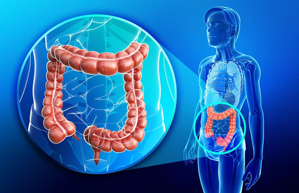 Oncolysin - Sản phẩm thảo dược hỗ trợ điều trị u đại tràng ác tính hiệu quả