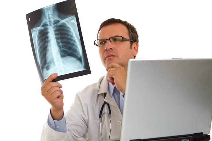 Những phương pháp điều trị ung thư phổi hiện nay là gì?