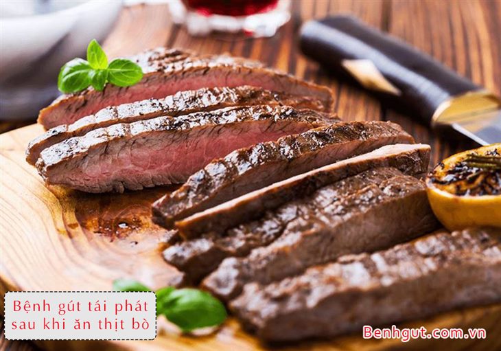 Cứ ăn thịt bò bệnh gút lại tái phát, hãy sử dụng ngay sản phẩm Hoàng Thống Phong
