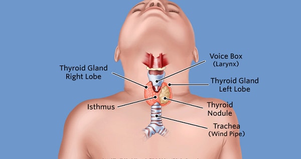 8 dấu hiệu của bệnh bướu cổ ở trẻ em mà các bậc cha mẹ cần lưu tâm!