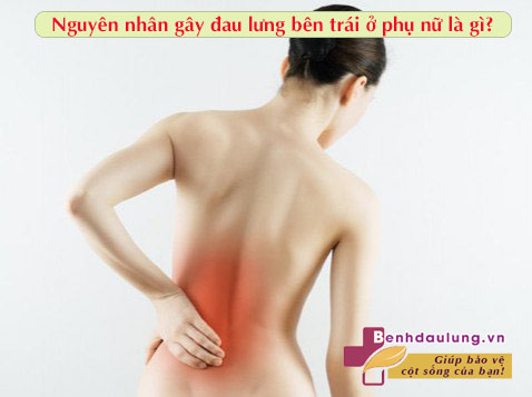 Đau lưng bên trái ở phụ nữ có nguy hiểm không?   