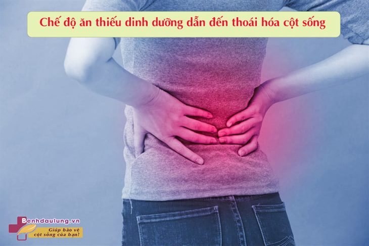 Điều trị thoái hóa cột sống thắt lưng bằng vật lý trị liệu có khỏi được không? 