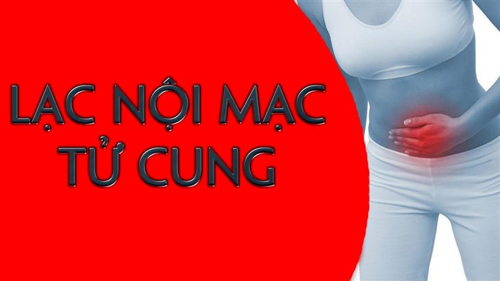 Lạc nội mạc tử cung là gì? Bệnh hình thành và gây ra những ảnh hưởng như thế nào?