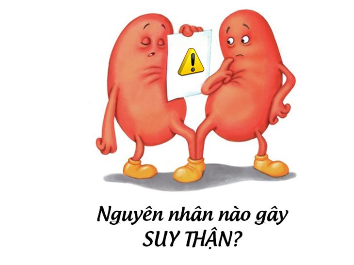 Có phải sỏi thận là nguyên nhân dẫn đến suy thận?