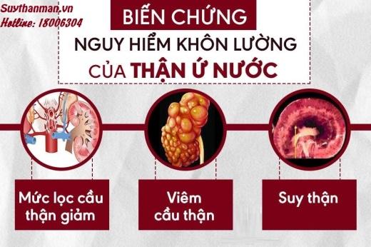 Thận ứ nước độ 4 có nguy hiểm không? Cần làm gì để cải thiện bệnh hiệu quả?