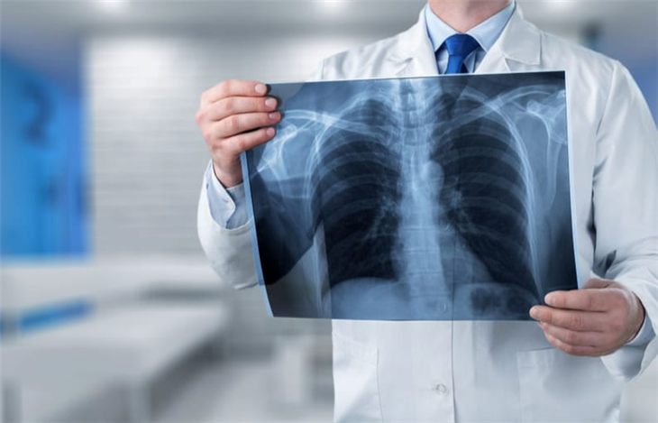 Làm sao để chẩn đoán ung thư phổi một cách chính xác?