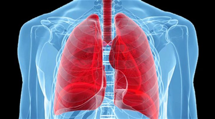 U phổi lành tính và u phổi ác tính là những tình trạng như thế nào?
