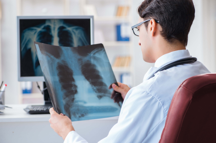 Phương pháp điều trị u phổi hiện nay là gì?