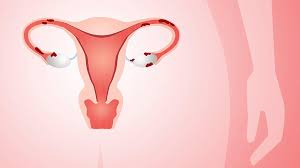 Phụ nữ cần lưu ý những vấn đề gì để có thể phát hiện và phòng ngừa lạc nội mạc tử cung?
