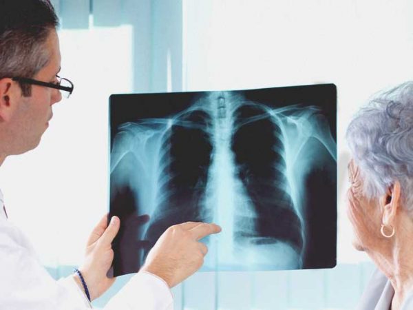 Có vết mờ ở phổi nhưng chưa ảnh hưởng tới sức khỏe thì có cần đi thăm khám và điều trị không?