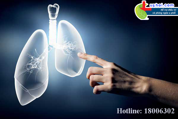 Giải pháp nào cho người bị ung thư phổi không hóa xạ trị? XEM NGAY!