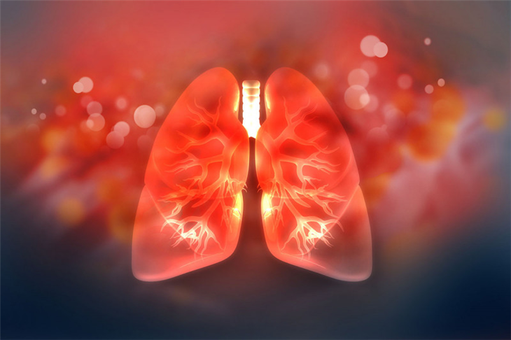 Bị ung thư màng phổi giai đoạn 4 nên điều trị như thế nào?
