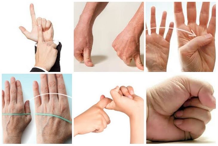 Chữa cứng khớp ngón tay như thế nào để hiệu quả? XEM NGAY TẠI ĐÂY!