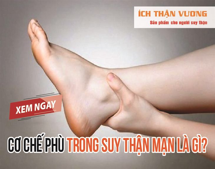 Cơ chế phù trong suy thận mạn và cách cải thiện hiệu quả với Ích Thận Vương. CLICK XEM NGAY!