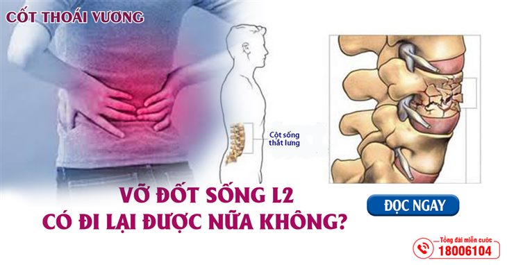 Khi bị vỡ đốt sống L2 có đi lại được nữa không? Điều trị như thế nào?