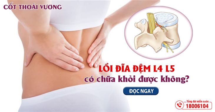 Lồi đĩa đệm L4 L5 có chữa khỏi được không?