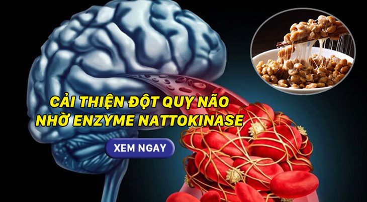 Cải thiện đột quỵ não nhờ enzyme nattokinase từ thiên nhiên. XEM NGAY!