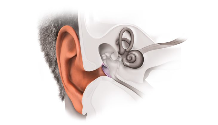 Phương pháp nào phòng ngừa suy giảm thính lực?
