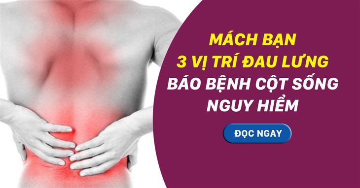 MÁCH BẠN 3 vị trí đau lưng báo hiệu bệnh cột sống nguy hiểm