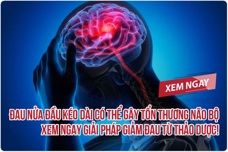 Đau nửa đầu kéo dài có thể gây tổn thương não bộ - Xem ngay giải pháp giảm đau từ thảo dược!