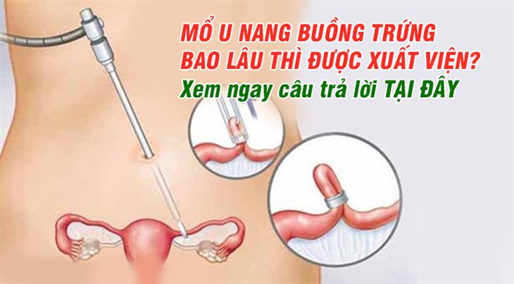 Mổ u nang buồng trứng bao lâu thì được xuất viện? Xem ngay câu trả lời TẠI ĐÂY