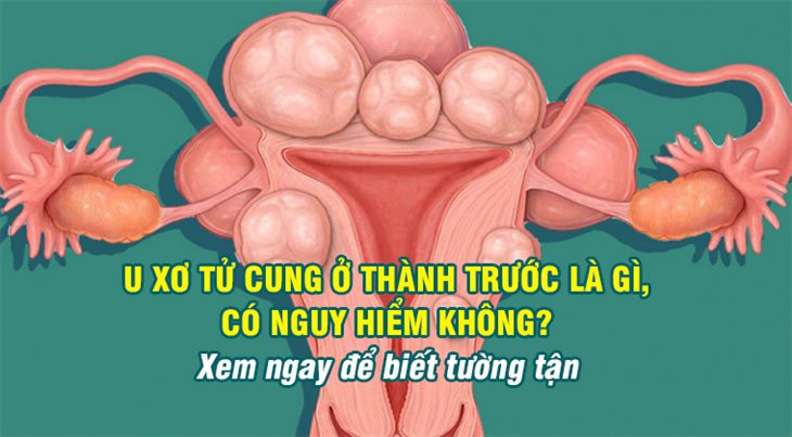 U xơ tử cung ở thành trước là gì, có nguy hiểm không? Xem ngay để biết tường tận