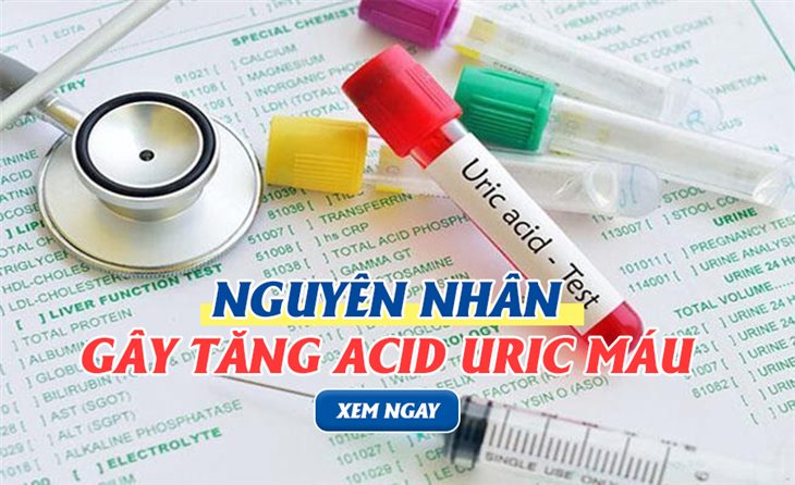 Những nguyên nhân gây tăng acid uric máu phổ biến không phải ai cũng biết