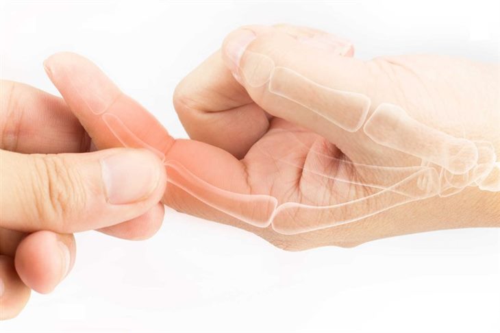Mách bạn: 3 cách chữa đau khớp ngón tay giữa đơn giản tại nhà