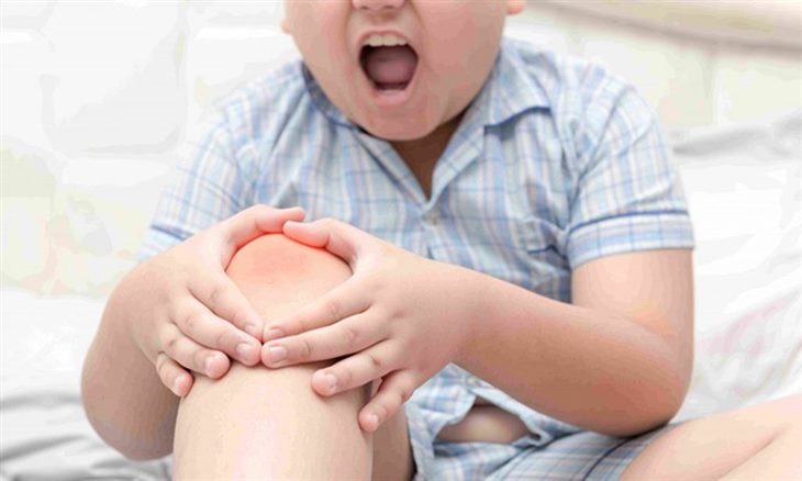 Nguyên nhân viêm khớp dạng thấp ở trẻ em và biện pháp khắc phục