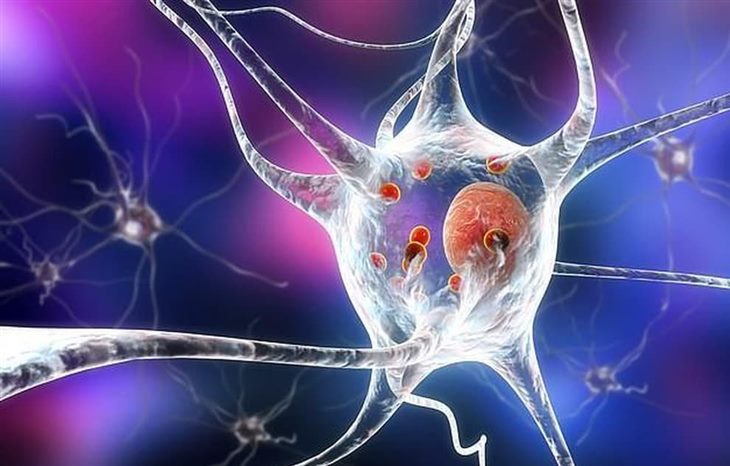 Các tế bào não bị tổn thương gây cản trở dẫn truyền thần kinh dẫn tới sa sút trí tuệ