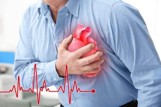 Hội chứng lú lẫn có thể xuất hiện từ từ ở những người mắc bệnh lý về tim