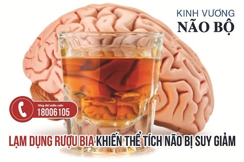 Uống rượu, bia quá độ - Nguyên nhân dẫn đến teo não chuẩn 100%