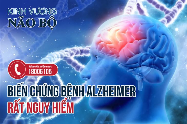 Biến chứng bệnh Alzheimer sẽ không hỏi thăm nếu bạn biết tới Kinh Vương Não Bộ, xem ngay!