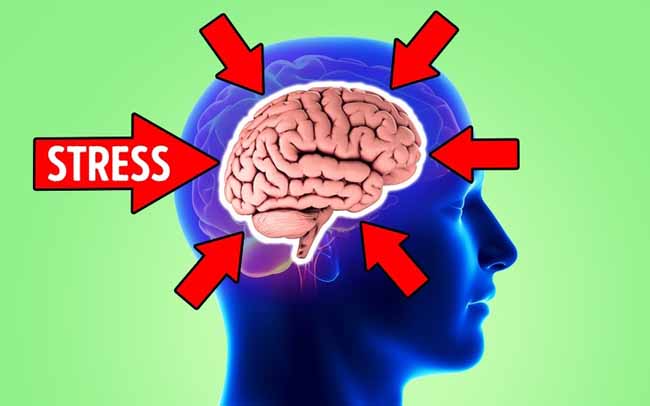 Stress nặng có thể gây teo não