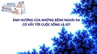 BS CKI Nguyễn Hồng Hải trả lời 2 thắc mắc của độc giả về bệnh ngoài da có vẩy 