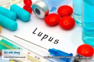 Hỗ trợ điều trị lupus ban đỏ bằng Kim Miễn Khang có gặp tác dụng phụ gì không?