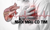Tăng huyết áp kéo dài có dẫn đến nhồi máu cơ tim không? PGS.TS. Nguyễn Minh Hiện giải đáp