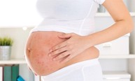 Viêm da cơ địa khi mang thai có ảnh hưởng gì không? Chuyên gia Nguyễn Thành tư vấn