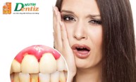 Tình hình bệnh răng miệng ở nước ta hiện nay như thế nào? Chuyên gia Nguyễn Hồng Hải tư vấn