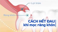 Dùng Nutridentiz phòng ngừa đau răng, viêm lợi do mọc răng khôn có hiệu quả không?