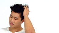Bị vảy nến da đầu nên chăm sóc và điều trị như thế nào? Có dùng Kim Miễn Khang và Explaq được không?