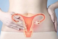 U xơ tử cung gây đau bụng dưới rối loạn kinh nguyệt phải làm sao?