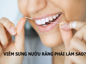 Viêm sưng nướu răng phải làm sao để khắc phục? XEM NGAY