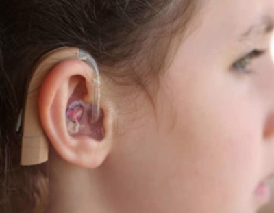  Đeo máy trợ thính có giúp cải thiện điếc tai?