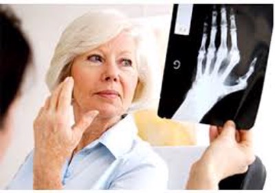 Những lưu ý trong điều trị viêm khớp dạng thấp