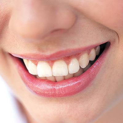 Hiến kế: 3 cách giúp bạn phòng bệnh viêm quanh răng hiệu quả