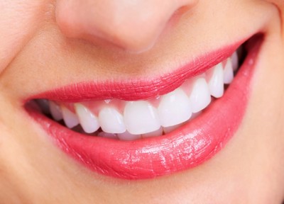 3 điều cần chú ý khi muốn điều trị viêm quanh răng