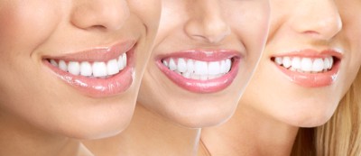Bất ngờ: 1/5 số người Mỹ không được điều trị sâu răng